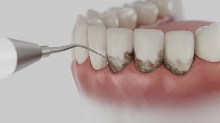 Reliable Dental contractor in Spencerville, OH by Dentist Open Now